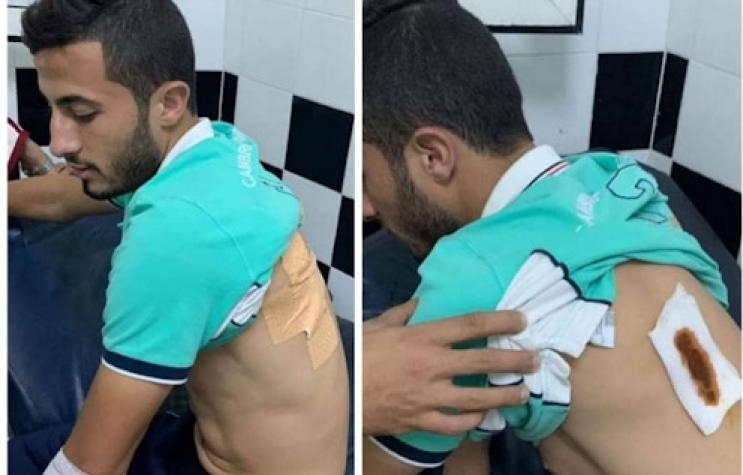  "الاعتداء" على الحسوني.. تضارب الروايات والتحقيق يستعين بكاميرات المراقبة 