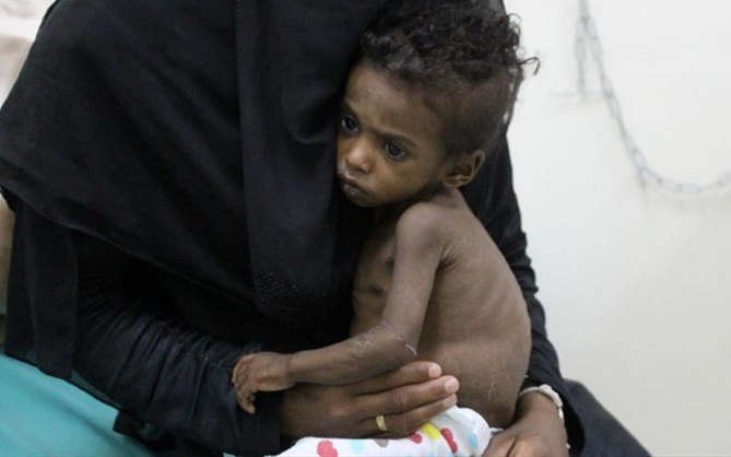 91 مليون شخص يمرضون سنويا بالطعام الملوث