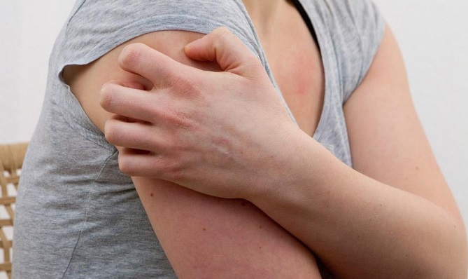  "غوغل" تستطيع التعرف على 26 مرض جلدي بدقة 