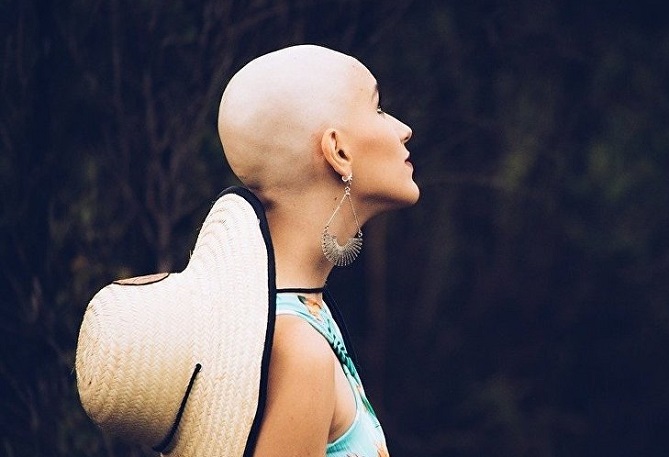  ابتكار عقار يمنع سقوط شعر مرضى السرطان 