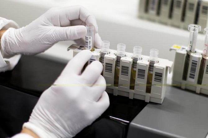 علماء يكتشفون مكان اختباء فيروس السيدا في الجسم