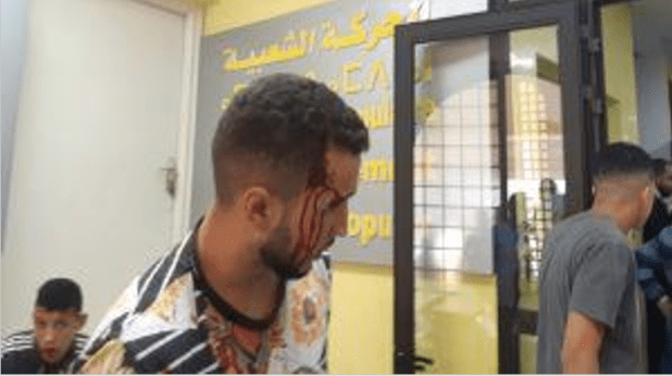 ضرب وجرح وتراشق بالكراسي وتدخل للأمن في دورة لشبيبة "الحركة الشعبية"