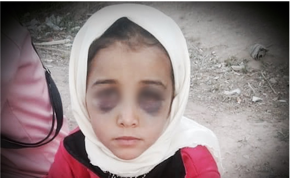 اعتداء على تلميذة يهز المغرب.. وضغط الفيسبوك يجر القضية إلى المحكمة