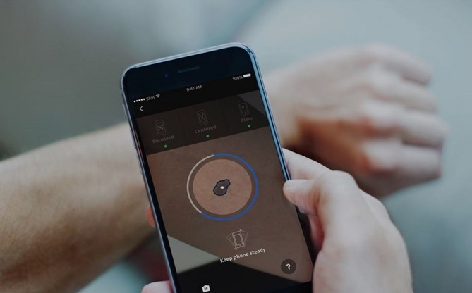 بريطاني ينجو من السرطان بفضل تطبيق ذكي