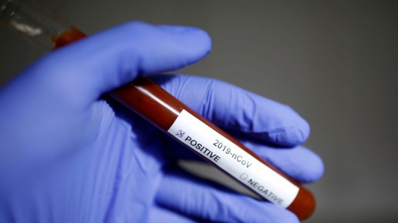 السويد تعلن عن أول إصابة مؤكدة بفيروس كورونا