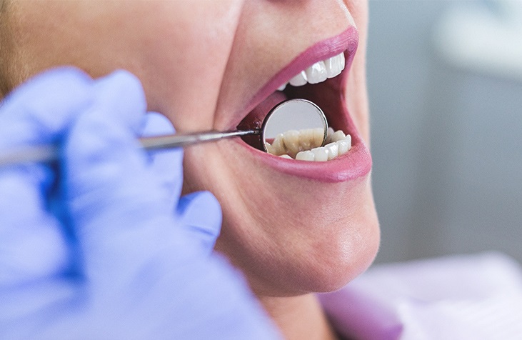  هكذا تؤثر الأسنان على صحة بقية أعضاء الجسد 