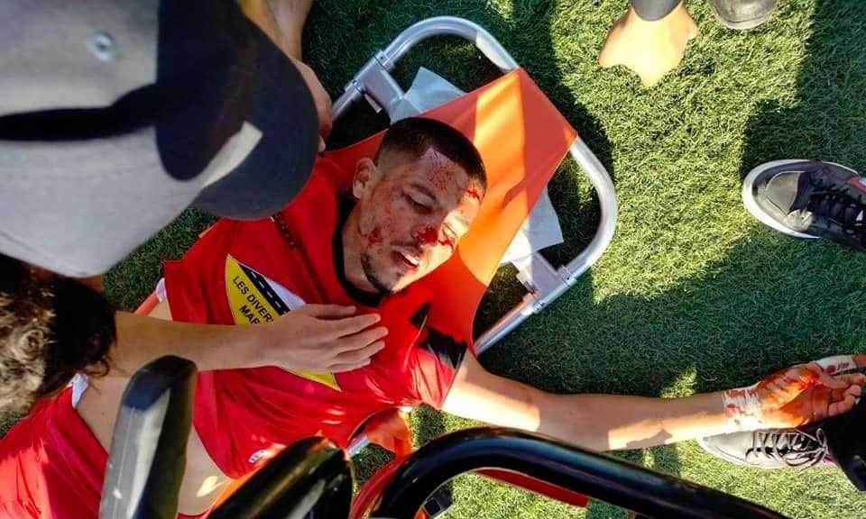 إصابات متفاوتة الخطورة للاعبين من فريق اتحاد سيدي قاسم اثر اعتداء تعرض له الفريق من لاعبي ومسيري فريق مولودية الداخلة