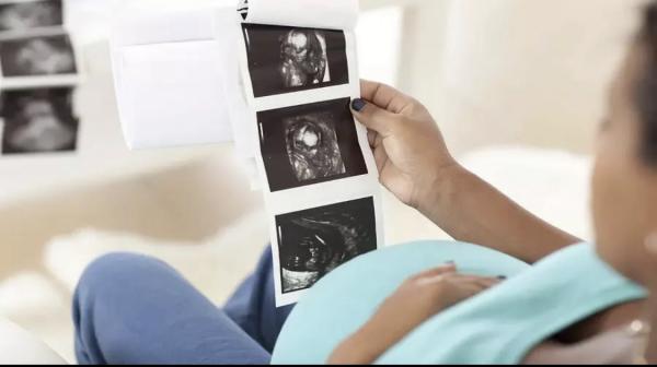  سيدة من مالي تنجب 9 أطفال توائم بإحدى المصحات الخاصة بالدار البيضاء 