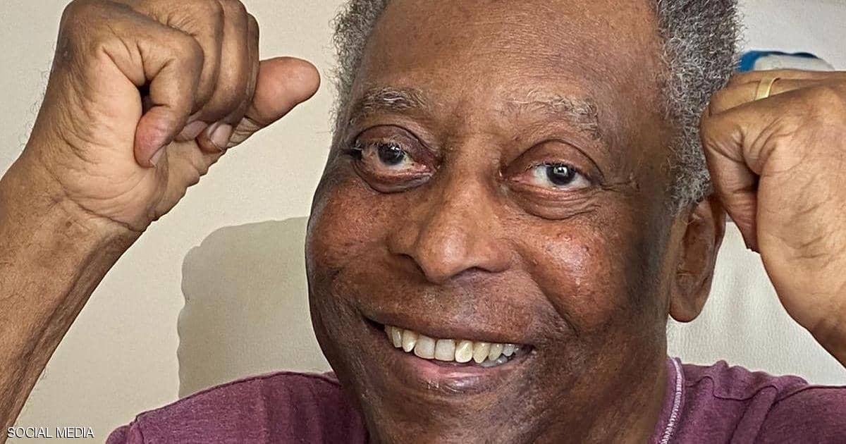 الأسطورة بيليه يغادر المستشفى بعد تعافيه من عملية جراحة