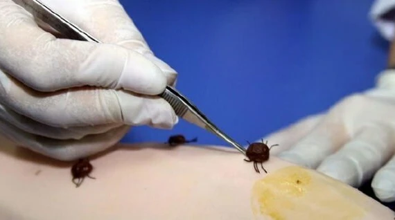 موريتانيا: تسجيل حالة وفاة بحمى القرم النزفية