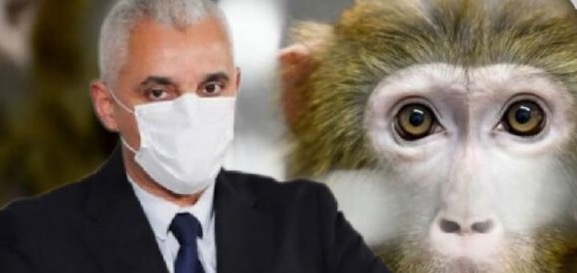 وزارة الصحة: النتائج المخبرية للحالات الثلاث المشتبه في إصابتها بفيروس جدري القردة جاءت سلبية