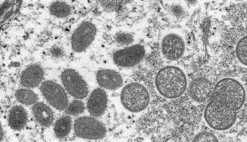 هل تتفشى الإصابة بجدري القرود؟.. العلماء يحسمون الجدل