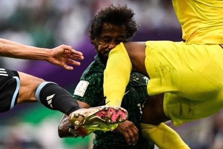  كسر في الوجه ينهي مشوار اللاعب السعودي ياسر الشهراني في كأس العالم بقطر 