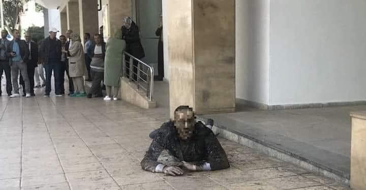 احتج على التجويع ورفض بنسعيد استقباله.. فنان مسرحي يُضرم النار في جسده أمام مقر وزارة الثقافة احتجاجا على معاشه الهزيل