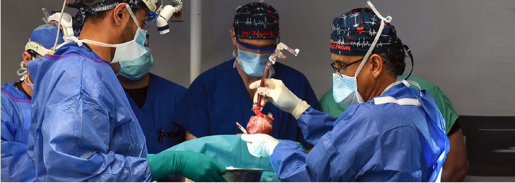 للمرة الثانية في أقل من عامين.. نجاح زرع قلب خنزير في جسم إنسان