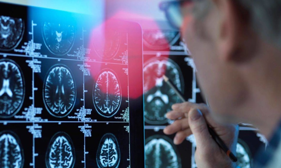 دراسة: الذكاء الاصطناعي يرصد السرطان بدقة أكبر من الأطباء