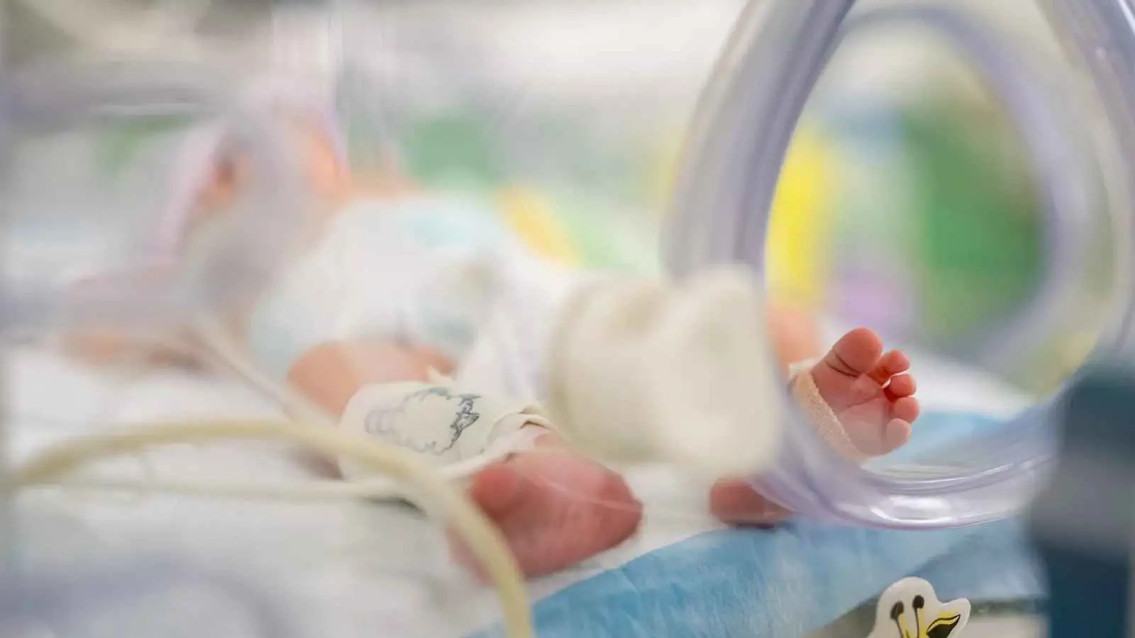 فصل أربع توائم ملتصقة بالمغرب تكللت جميعها بالنجاح