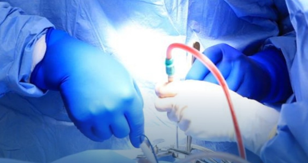  فريق طبي بمراكش ينجح في إعادة زرع يد مبتورة في عملية معقدة 