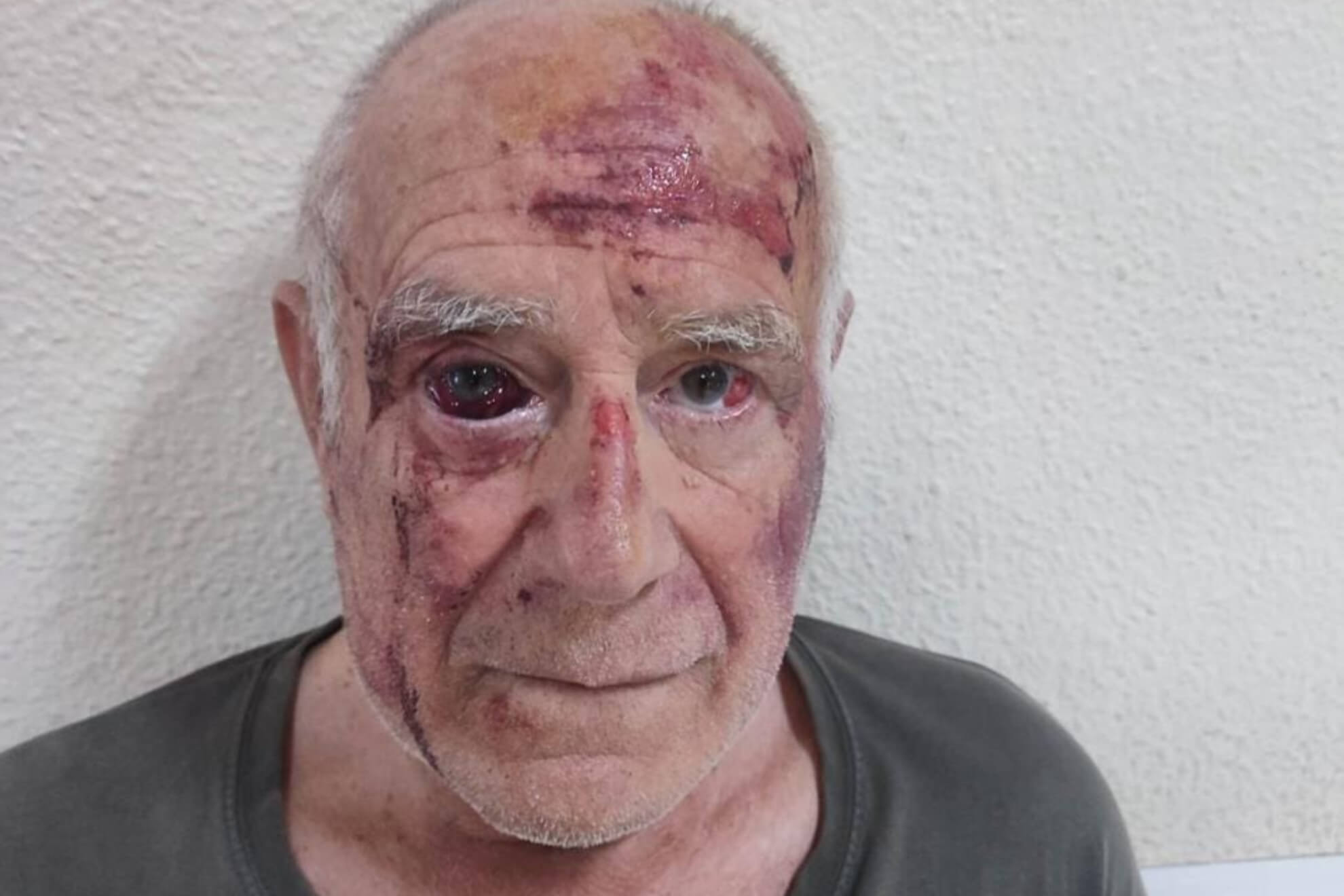 اسبانيا.. اعتداء على مسن إسباني في مورسيا يثير موجة استغلال سياسي وتحريض عنصري ضد المغاربة وسط تحذيرات من تكرار سيناريو "إل إيخيدو" سنة 2000