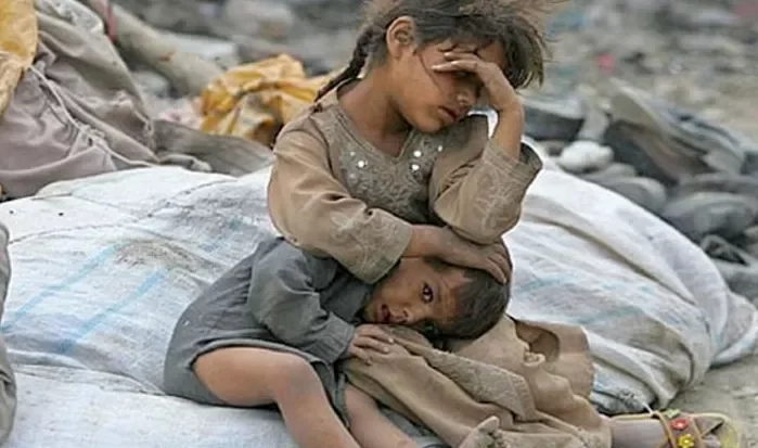 الأمم المتحدة: أزمة جوع حاد تهدد 18 مليونا باليمن بدءا من سبتمبر