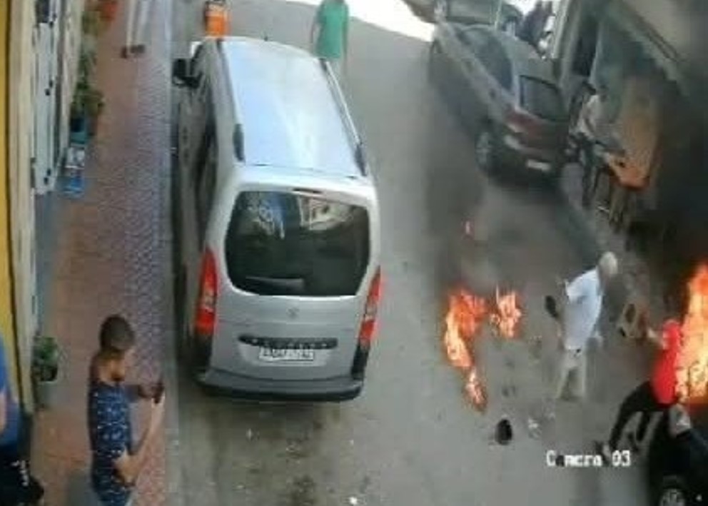 وفاة الفنان سوليت بمستشفى طنجة الجامعي متأثرا بحروقه بعد الاعتداء المروع بالحسيمة