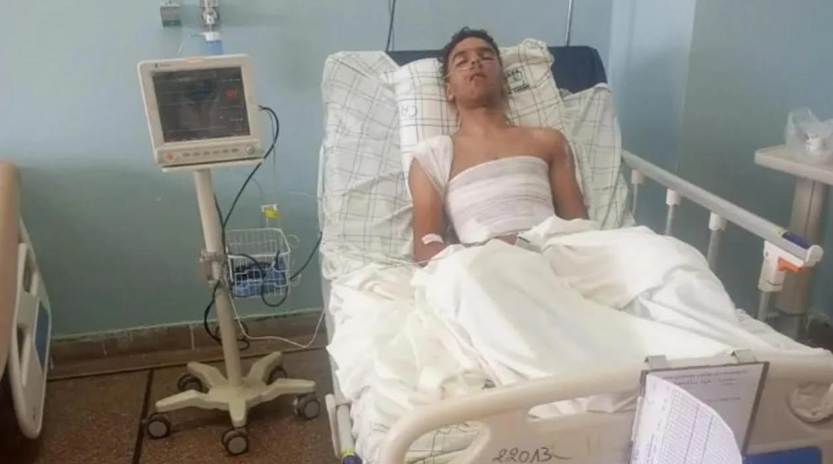  المستشفى الجامعي بوجدة ينفي تدهور الحالة الصحية لشاب أصيب في الاحتجاجات 